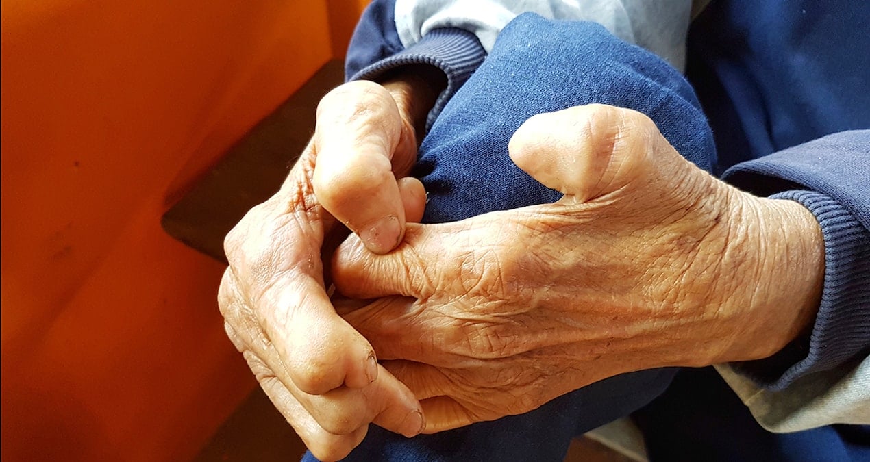 sadece kemikleriniz degil kaslariniz da erimesin Y7sx9qZK