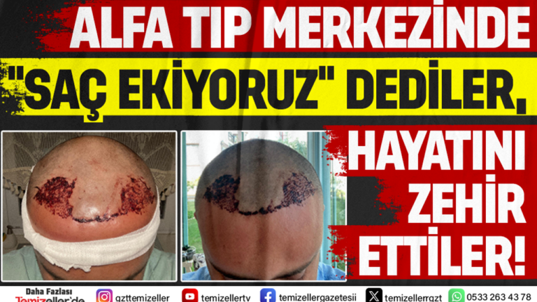 alfa-tip-merkezinde-sac-ekiyoruz-dediler-hayati-zehir-ettiler-SOIA1Wk4.png